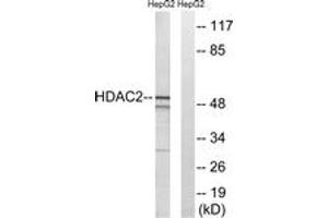Western blot analysis of extracts from HepG2 cells, using HDAC2 (Ab-394) Antibody. (HDAC2 抗体  (AA 360-409))