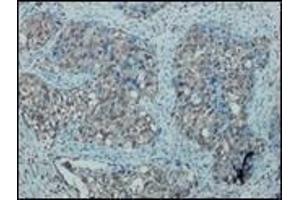 Immunohistochemistry (IHC) image for anti-Nitric Oxide Synthase 2, Inducible (NOS2) antibody (ABIN870300) (NOS2 抗体)