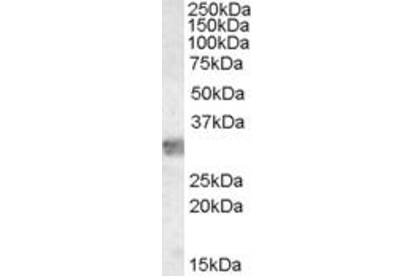 MYD88 抗体  (Internal Region)