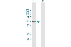 Western Blot analysis of KIAA1576 expression in transfected 293T cell line by KIAA1576 MaxPab polyclonal antibody. (VAT1L 抗体  (AA 1-419))