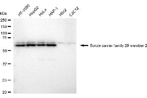 Western blotting analysis using solute carrier family 29 member 2 antibody (ABIN7800394).