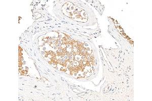 Immunohistochemistry (IHC) image for anti-Vinculin (VCL) (AA 1016-1066) antibody (ABIN7454836) (Vinculin 抗体  (AA 1016-1066))