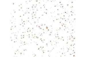 Immunocytochemistry (ICC) image for anti-Interferon, gamma-Inducible Protein 16 (IFI16) (AA 350-400) antibody (ABIN7795822)