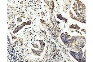 IHC analysis of BCKDK using anti-BCKDK antibody (ABIN7601470).