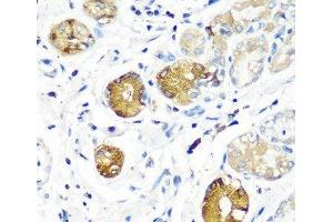 Immunohistochemistry of paraffin-embedded Human stomach using SGSH Polyclonal Antibody at dilution of 1:100 (40x lens). (SGSH 抗体)