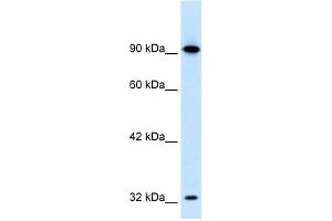 WB Suggested Anti-SOX30 Antibody Titration:  0. (SOX30 抗体  (Middle Region))