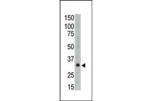 The anti-GEA6 C-term Antibody (ABIN390109 and ABIN2840621) is used in Western blot to detect GEA6 in A549 lysate. (MAGEA6 抗体  (C-Term))