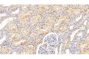 Detection of F12 in Human Kidney Tissue using Polyclonal Antibody to Coagulation Factor XII (F12) (F12 抗体  (AA 400-615))