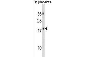 MYL12B Antibody (N-term) (ABIN1881561 and ABIN2838709) western blot analysis in human placenta tissue lysates (35 μg/lane). (MYL12B 抗体  (N-Term))