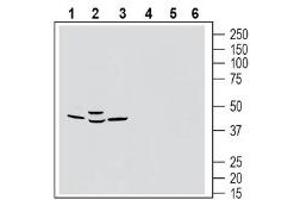 Western blot analysis of rat brain membranes (lanes 1 and 4), mouse brain lysates (lanes 2 and 5) and rat lung membranes (lanes 3 and 6):1-3. (G Protein-Coupled Receptor 183 (GPR183) Peptide)