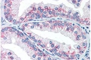 Human Prostate (formalin-fixed, paraffin-embedded) stained with AKT1S1 antibody ABIN337263 at 10 ug/ml followed by biotinylated anti-mouse IgG secondary antibody ABIN481714, alkaline phosphatase-streptavidin and chromogen. (PRAS40 抗体)