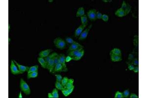 Immunofluorescent analysis of HepG2 cells using ABIN7142110 at dilution of 1:100 and Alexa Fluor 488-congugated AffiniPure Goat Anti-Rabbit IgG(H+L)