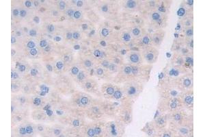 Detection of ATF6 in Mouse Liver Tissue using Polyclonal Antibody to Activating Transcription Factor 6 (ATF6) (ATF6 抗体  (AA 1-377))