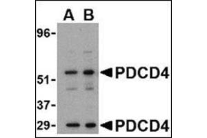 Western blot analysis of PDCD4 in A-20 cell lysate with this product at (A) 0. (PDCD4 抗体  (C-Term))