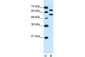 WB Suggested Anti-SIL1 Antibody Titration:  0. (SIL1 抗体  (N-Term))