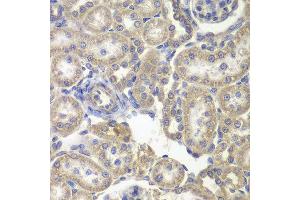 Immunohistochemistry of paraffin-embedded rat kidney using H6PD antibody at dilution of 1:200 (400x lens). (Glucose-6-Phosphate Dehydrogenase 抗体)