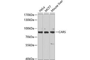 Western blot analysis of extracts of various cell lines, using CARS antibody (ABIN6129260, ABIN6137946, ABIN6137948 and ABIN6222203) at 1:1000 dilution. (CARS 抗体  (AA 469-748))