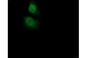 Immunofluorescence (IF) image for anti-Acireductone Dioxygenase 1 (ADI1) antibody (ABIN1496483) (ADI1 抗体)