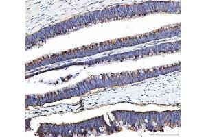 IHC analysis of UBA5 using anti-UBA5 antibody (ABIN7601503). (UBA5 抗体  (AA 37-389))