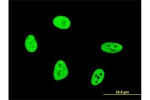 Immunofluorescence of monoclonal antibody to OXSR1 on HeLa cell. (OXSR1 抗体  (AA 351-450))