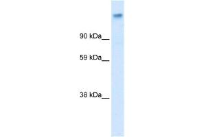 WB Suggested Anti-CACNA2D1 Antibody Titration:  0. (CACNA2D1 抗体  (Middle Region))