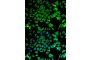 Immunofluorescence analysis of U2OS cells using N antibody (ABIN6129932, ABIN6144318, ABIN6144319 and ABIN6222781). (NAA10 抗体  (AA 161-235))