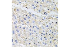 Immunohistochemistry of paraffin-embedded mouse liver using IGF1R antibody (ABIN5970073) at dilution of 1/100 (40x lens). (IGF1R 抗体  (N-Term))