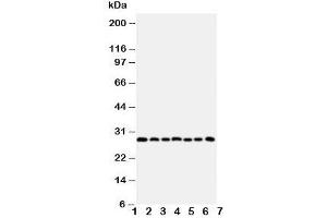 Western blot testing of Kallikrein-11 antibody and Lane 1:  U87;  2: A549; 3: HeLa;  4: MM231;  5: MM453;  6: COLO320;  7: Jurkat cell lysate. (Kallikrein 11 抗体  (C-Term))