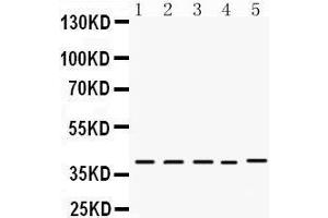 Western Blotting (WB) image for anti-Doublesex and Mab-3 Related Transcription Factor 1 (DMRT1) (AA 98-128), (N-Term) antibody (ABIN3043450) (DMRT1 抗体  (N-Term))