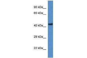 WB Suggested Anti-Gcdh Antibody   Titration: 1. (GCDH 抗体  (C-Term))