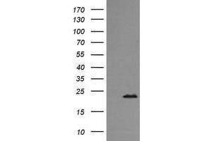 Image no. 1 for anti-RAB24, Member RAS Oncogene Family (RAB24) antibody (ABIN1500553) (RAB24 抗体)