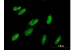Immunofluorescence of purified MaxPab antibody to ZBTB22 on HepG2 cell. (ZBTB22 抗体  (AA 1-634))