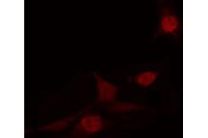 ABIN6274231 staining HT29 cells by IF/ICC. (FOXN2 抗体  (C-Term))