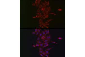 Immunofluorescence analysis of PC-12 cells using NRP2 Rabbit pAb (ABIN3016282, ABIN3016283, ABIN3016284, ABIN1681113 and ABIN6219689) at dilution of 1:50 (40x lens). (NRP2 抗体  (AA 150-420))