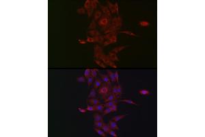 Immunofluorescence analysis of PC-12 cells using NRP2 Rabbit pAb (ABIN3016282, ABIN3016283, ABIN3016284, ABIN1681113 and ABIN6219689) at dilution of 1:50 (40x lens). (NRP2 抗体  (AA 150-420))
