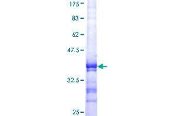 DGCR8 Protein (AA 675-771) (GST tag)