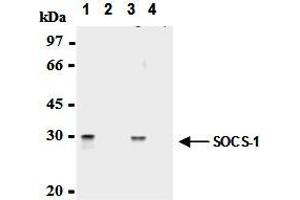 Immunoprecipitation of SOCS-1 from mouse splenocytes and mouse thymocytes with AM26561AF-N (1,3) or mouse IgG1 (2,4). (SOCS1 抗体  (AA 2-78))