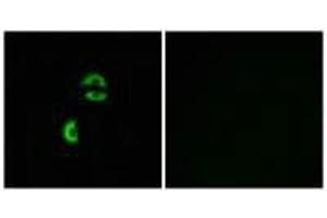 Immunofluorescence analysis of A549 cells, using LDLRAD3 antibody. (LDLRAD3 抗体)