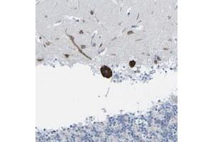 Immunohistochemical staining of human cerebellum with PDZK1IP1 polyclonal antibody  shows strong cytoplasmic positivity in purkinje cells. (PDZK1 Interacting Protein 1 (PDZK1IP1) 抗体)