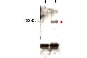 Western blot using  Protein A purified anti-Stat1 pY701 antibody shows detection of phosphorylated Stat1 (indicated by arrowhead at ~91 kDa) in K562 cells after 30 min treatment with 1Ku of hIFN-?