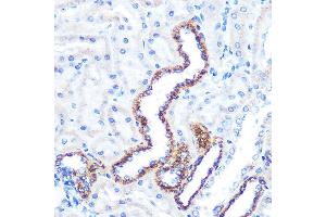 Immunohistochemistry of paraffin-embedded rat kidney using  Rabbit mAb (ABIN7265589) at dilution of 1:100 (40x lens). (Angiopoietin 2 抗体)