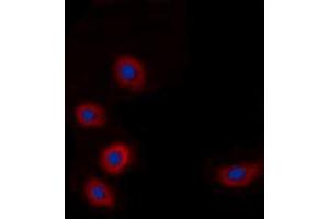 Immunofluorescent analysis of BRP44L staining in A549 cells. (BRP44L 抗体  (N-Term))
