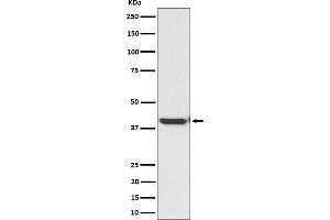 Western blot analysis of ENDOGL1 / ENGL expression in HepG2 cell lysate. (Recombinant EXOG 抗体)