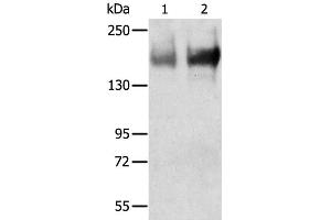 Western Blot analysis of Human jejunoileum and ileum tissue using TRPM6 Polyclonal Antibody at dilution of 1:200 (TRPM6 抗体)