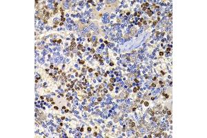 Immunohistochemistry of paraffin-embedded rat spleen using UBASH3B antibody (ABIN5974296) at dilution of 1/100 (40x lens). (UBASH3B 抗体)