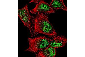 Fluorescent confocal image of Hela cell stained with MEF2C Antibody (S387). (MEF2C 抗体  (AA 365-394))