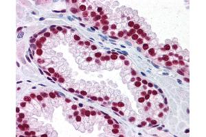 Anti-SAFB antibody IHC of human prostate. (SAFB 抗体  (AA 111-201))