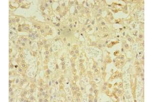 Immunohistochemistry of paraffin-embedded human adrenal gland tissue using ABIN7167480 at dilution of 1:100 (RIPK3 抗体  (AA 1-518))