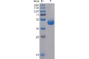Human TIGIT Protein, hFc Tag on SDS-PAGE under reducing condition.