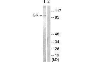 Western blot analysis of extracts from Jurkat cells, treated with EGF (200 ng/mL, 15 mins), using GR (Ab-226) antibody. (Glucocorticoid Receptor 抗体  (Ser226, Ser234, Ser246))